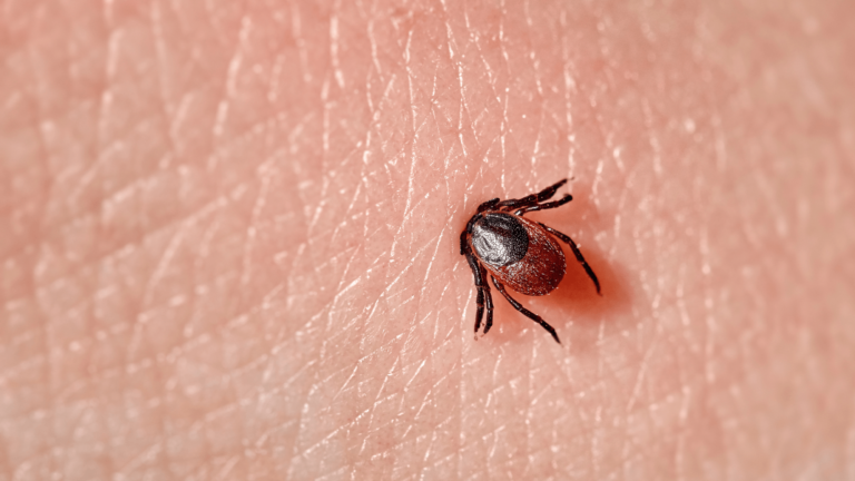 tick bite